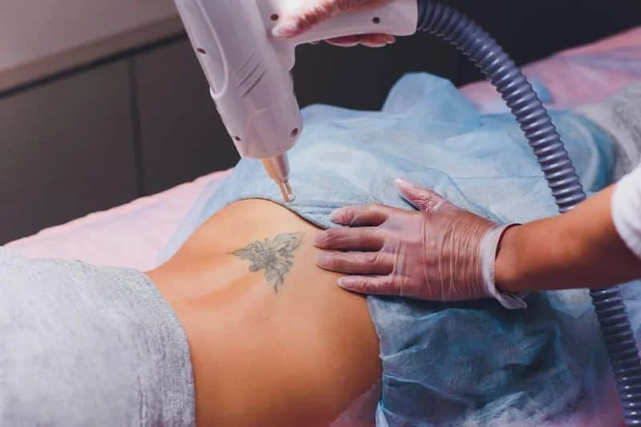 Laser vs Saline vs Surgery