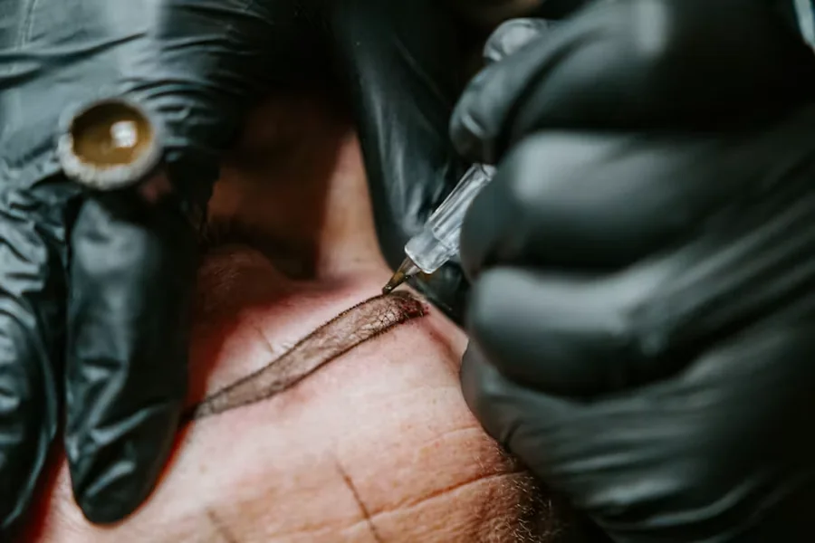 Tattooing