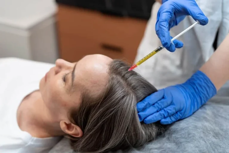 Hair Loss vs. Try Supplements First