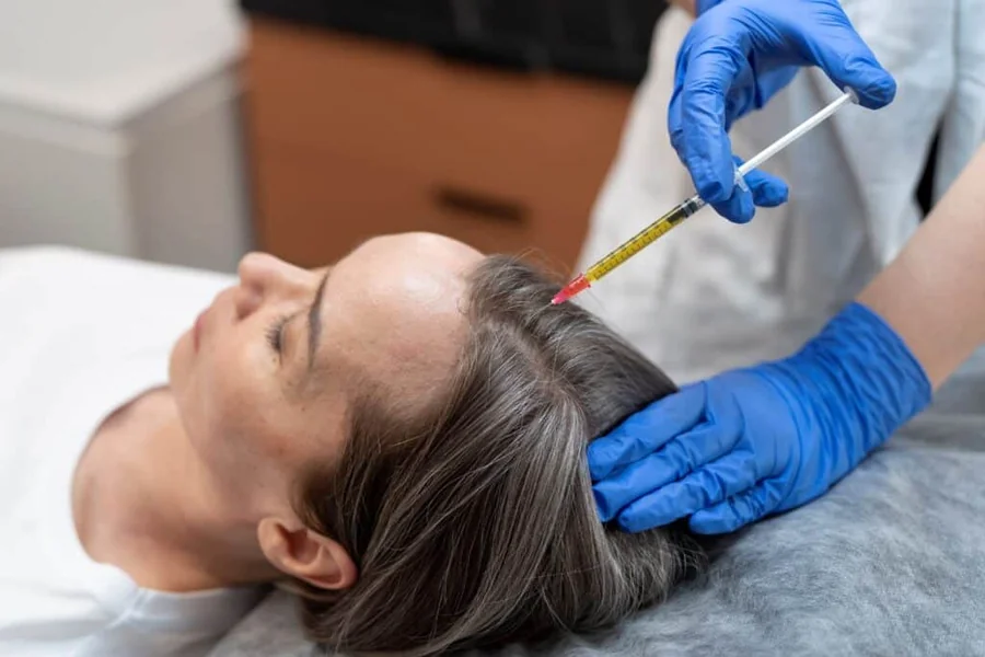 Hair Loss vs. Try Supplements First